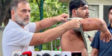 Rahul Gandhi का केंद्र पर बड़ा हमला, बोले- 'धर्मेंद्र प्रधान को जाना ही होगा', पैलेट गन पीड़ित छात्र के साथ रखीं 3 मांगें